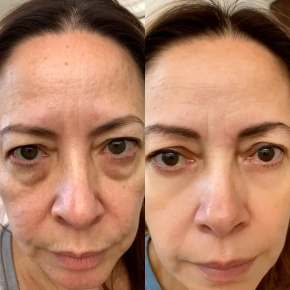 Lumera™ 2-in-1 Red Light + Microcurrent Eye Therapy